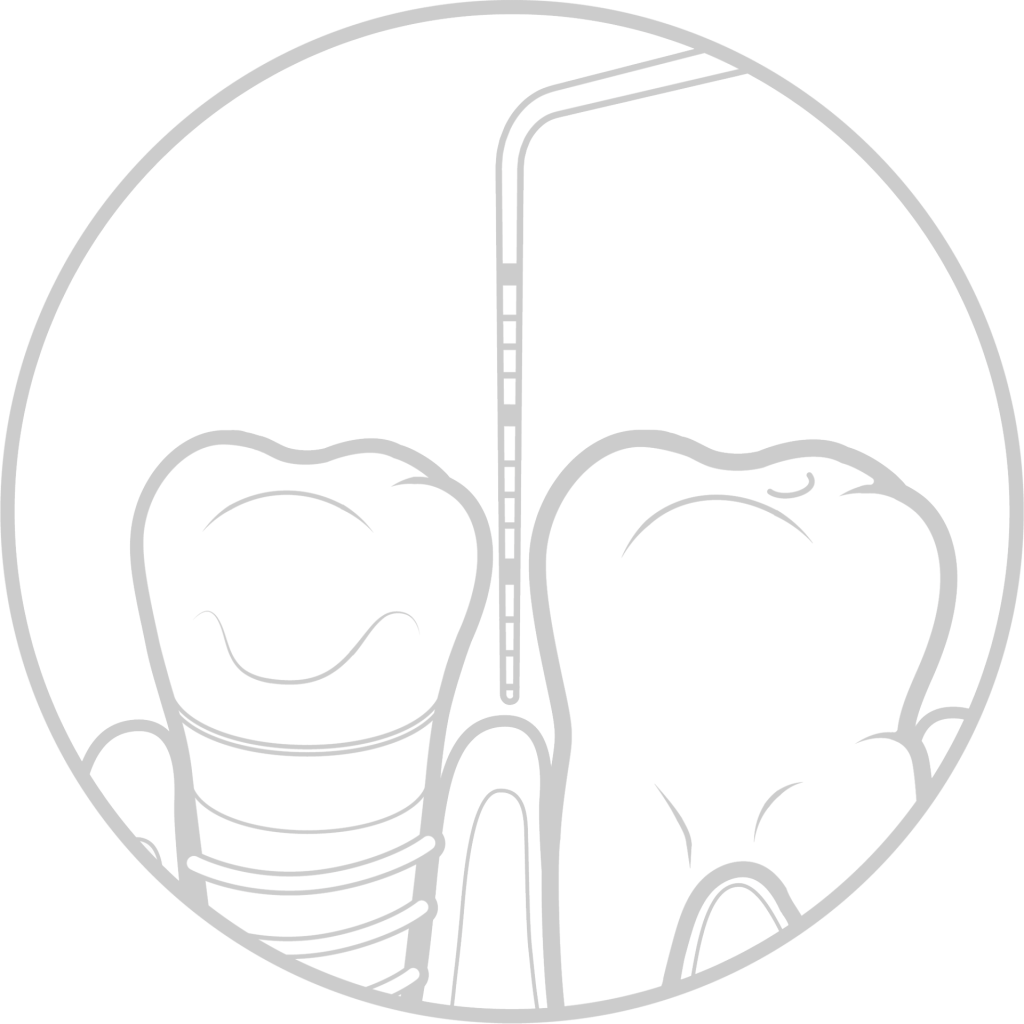 Guided Biofilm Therapy Professional Teeth Cleaning Pontefract